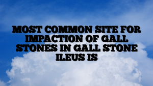 MOST COMMON SITE FOR IMPACTION OF GALL STONES IN GALL STONE ILEUS IS